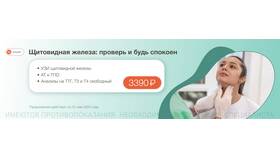 Что будет с акциями в апреле: прогнозы и тенденции в Техношок